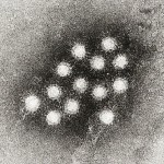 Case of Hepatitis Outbreak