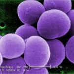 Staphylococcus-aureus-bacteria-taken-from-a-vancomycin-intermediate-resistant-culture